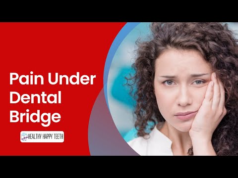 Pain Under Dental Bridge and How to Relieve It?