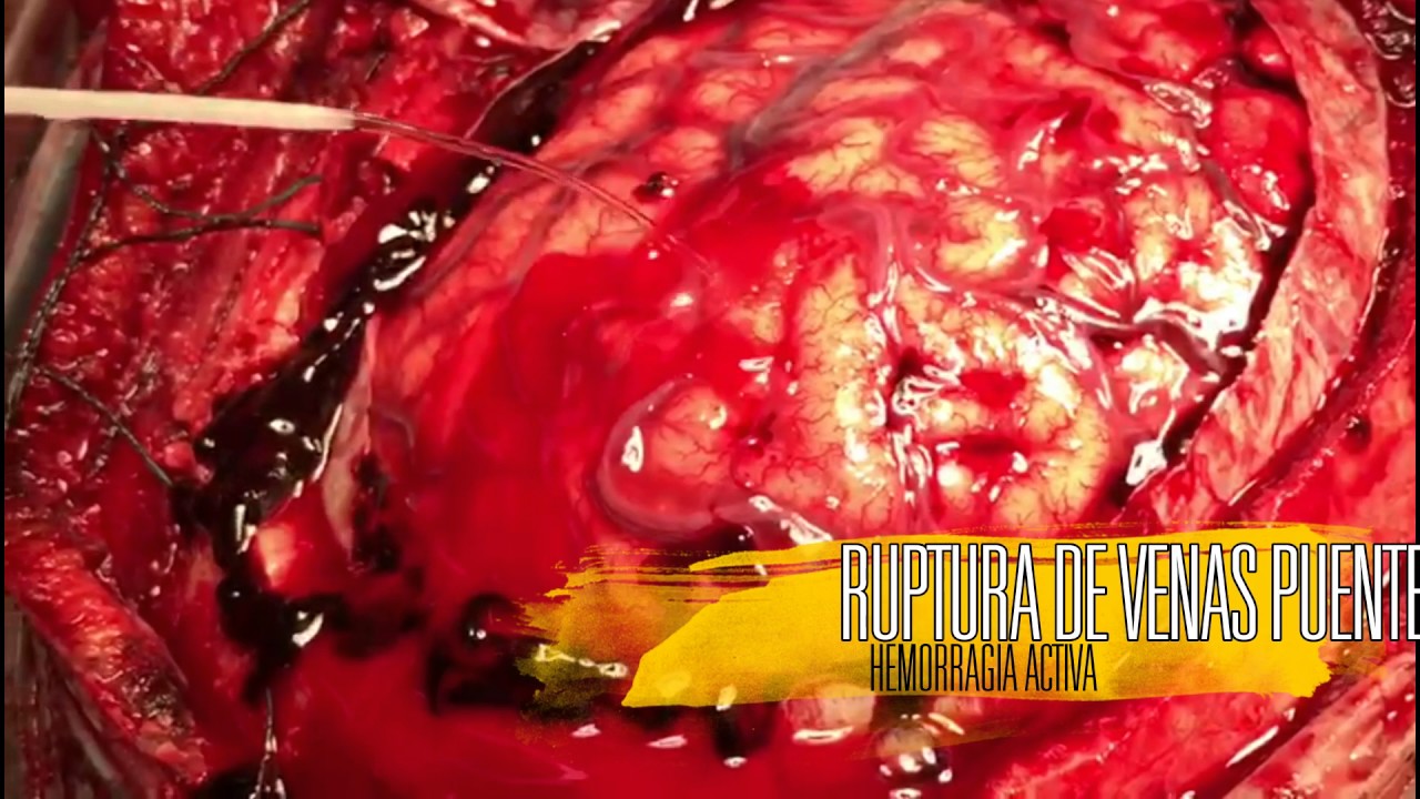 Jorge Octavio Olvera Castro-10