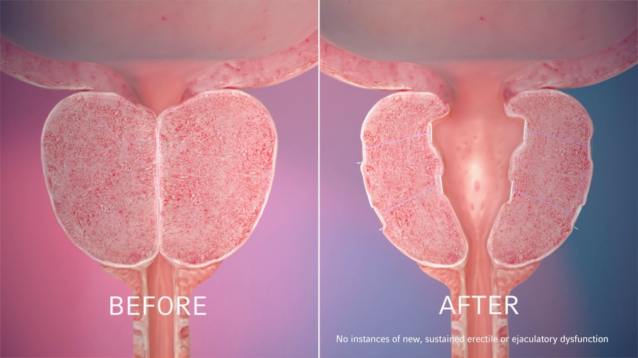 Fabio Sant Anna De Moraes-33