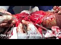 Hand Surgery Microsurgery Vascular Surgery Nerve Surgery Tendon Surgery Trauma