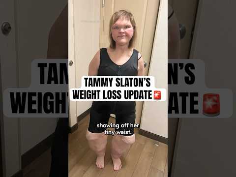 Tammy Slaton's Weight Loss Update #shorts #1000lbsisters