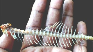 Ever Had Fish bone stuck in throat? Here is What you can do