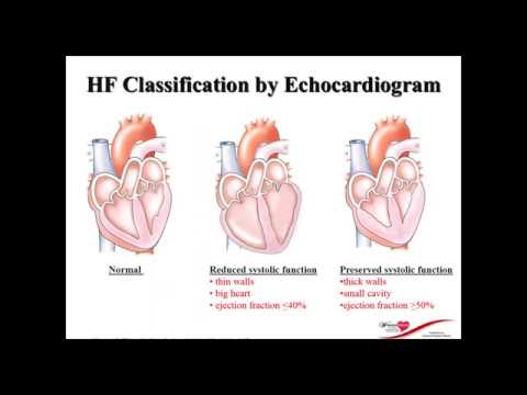 Heart Failure Guidelines Webinar