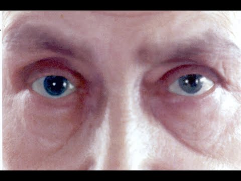 The Mother’s Order to Drive Away Harmful Force