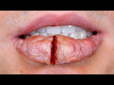 HUGE BUSTED LIP!