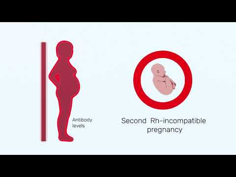How Rh factor affects a pregnancy