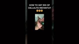 HOW I GET RID OF CELLULITE FAST! 😱 | YES IT REALLY WORKS! 😍