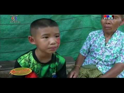 โรคสะเก็ดเงินรักษาแขนครีม หยดองค์ประกอบโรคสะเก็ดเงินยาเสพติด