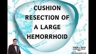 RESECTION OF A LARGE HEMORRHOID USING DIODE LASER- CUSHION RESECTION
