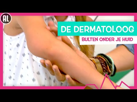 ONDERHUIDSE BULTEN OP JE LICHAAM - TOPDOKS SPECIALISME DERMATOLOOG