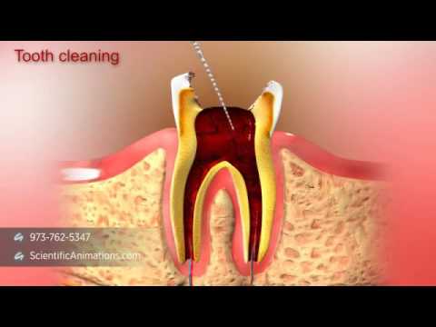 Elite Dental Care video.