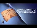 Pectus Excavatum Surgical Repair A Cin
