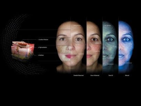 The OBSERV 520x scanner - professionally analyse your skin