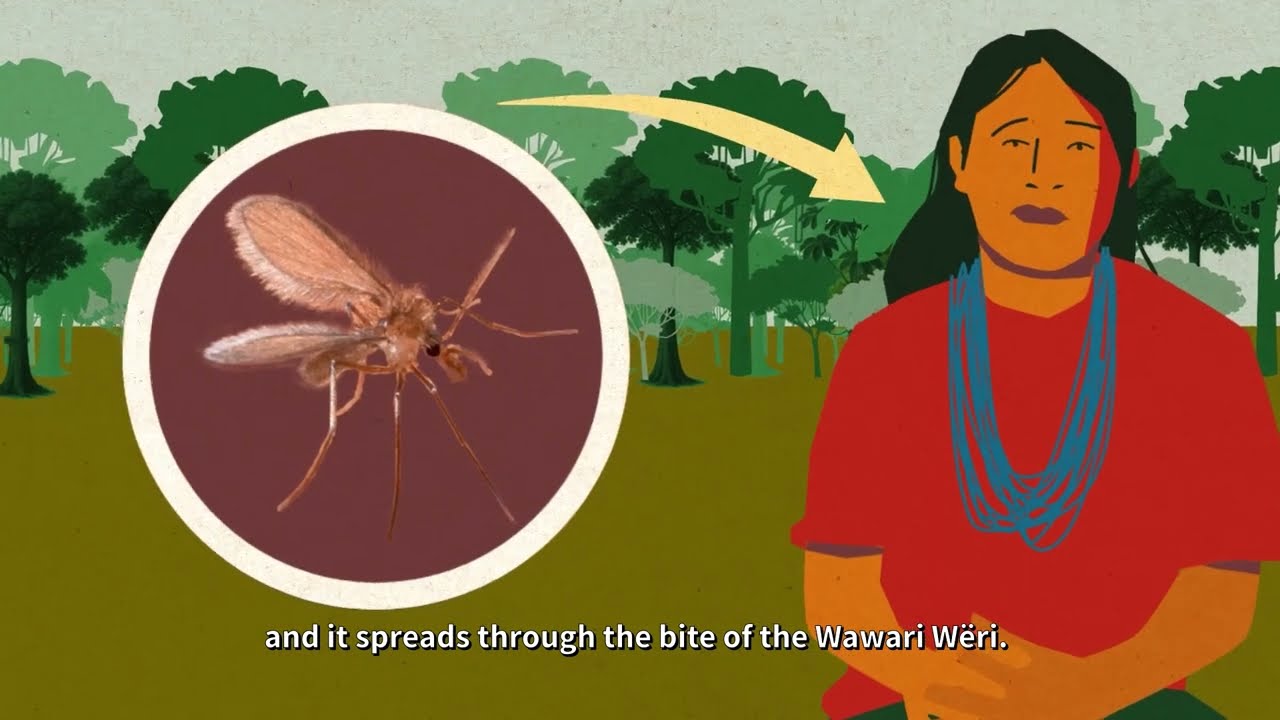 American Tegumentary Leishmaniasis