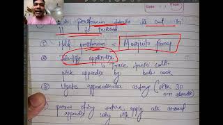 Appendectomy surgical procedure