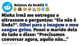 My sister handed me her ultrasound and I froze at what I saw.