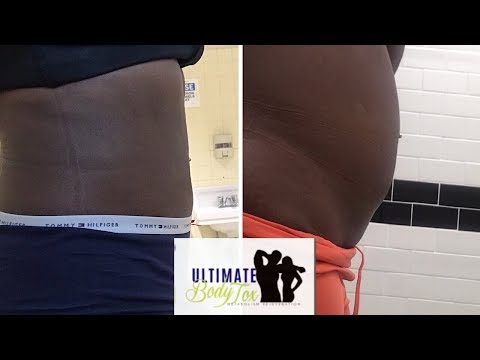 download lagu mp3 mp4 Ultimate Body Tox, download lagu Ultimate Body Tox gratis, unduh video klip Ultimate Body Tox