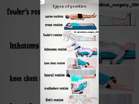 Type of present position 🧪🩺 #medical #nursingknowledge #positions