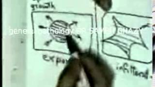 general pathology 29 : DR SAMEH GHAZY disturbanceofgrowthneoplasia1