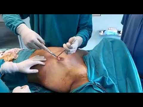 Patient Recovery Case — Video 31 (Facial Aesthetics)