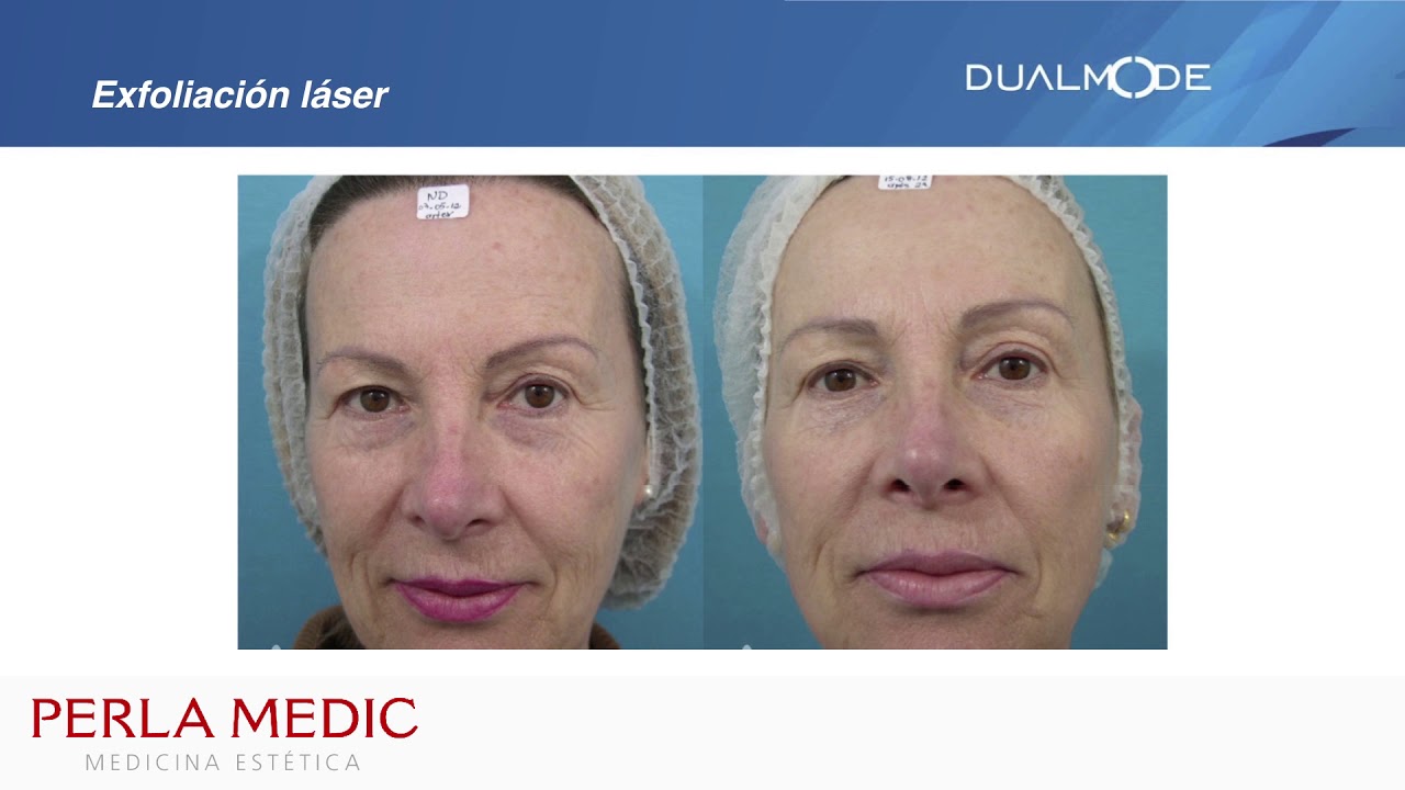 Mª Joanet Perera Rodriguez-55