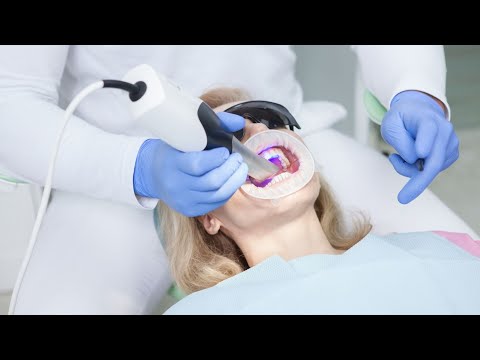 Knochentransplantation in der Implantologie - Wie kann sie den Erfolg von Zahnersatz sicherstel