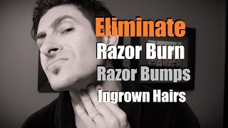 How To Eliminate Razor Burn, Bumps and Ingrown Hairs | Razor Burn Prevention