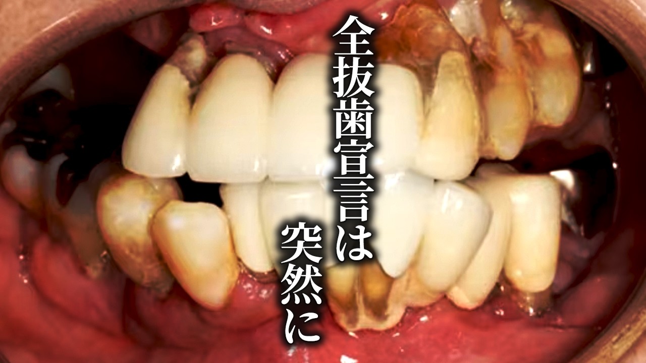 かかりつけ医から総入れ歯宣告を受けた女性の現実を受け止めるどころかかっ飛ばしました