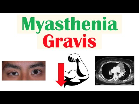 Myasthenia Gravis | Pathophysiology, Signs & Symptoms, Diagnosis, Treatment