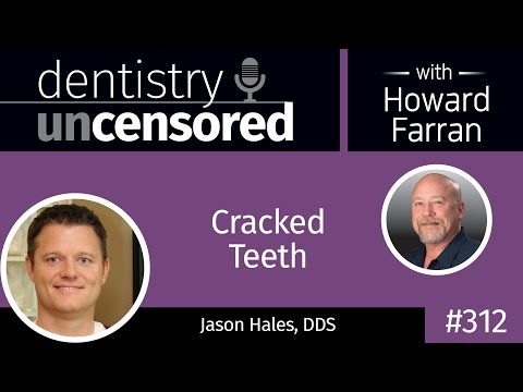 312 Cracked Teeth with Jason Hales : Dentistry Uncensored with Howard Farran
