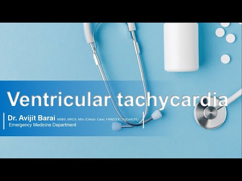 ECG Made Super Easy:  ECG criteria for ventricular tachycardia (VT) I SVT vs VT
