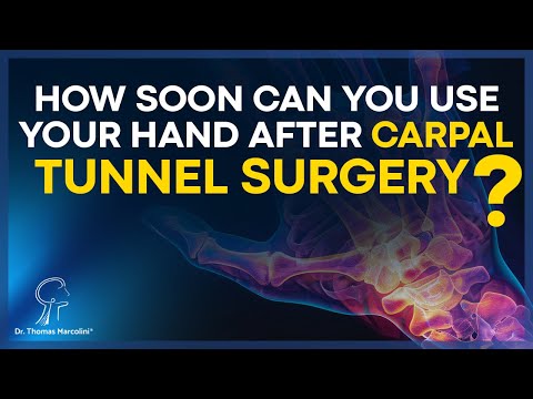 Carpal Tunnel Surgery Recovery: Timeline, Tips & What to Expect