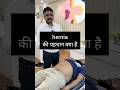 Umbilical Hernia कैसा दिखता है Trending Shortfeed Hernia