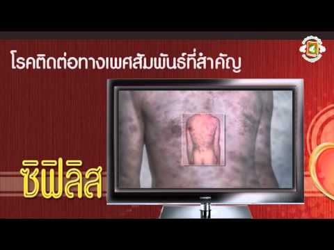 อดัมสูตรรากแรง ซื้อทุกอย่างจากความอ่อนแอ