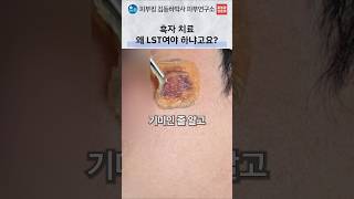 기미와 흑자 구분: 반복 토닝 전에 확인할 색소의 특징