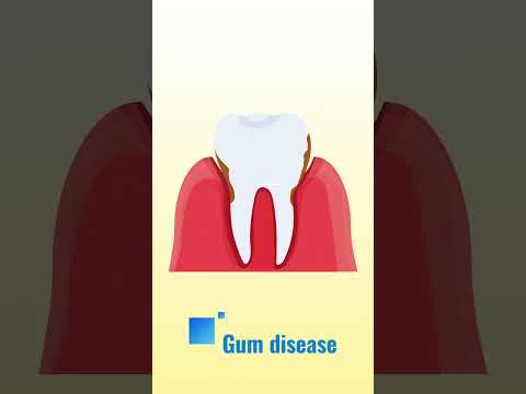 Your smile affects more than you think! Poor dental health can lead to serious issues