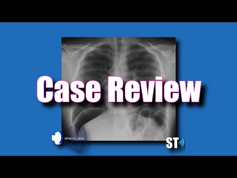 Case Review - Pneumoperitoneum