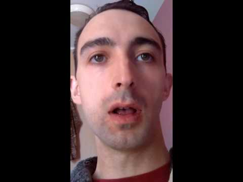 That feeling when you look in the mirror after having your wisdom teeth out!