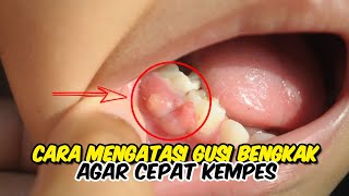 Download lagu HEALTH TIPS!! EASY WAYS TO TREAT SWELLED GUMS SO THEY DECLINE QUICKLY mp3