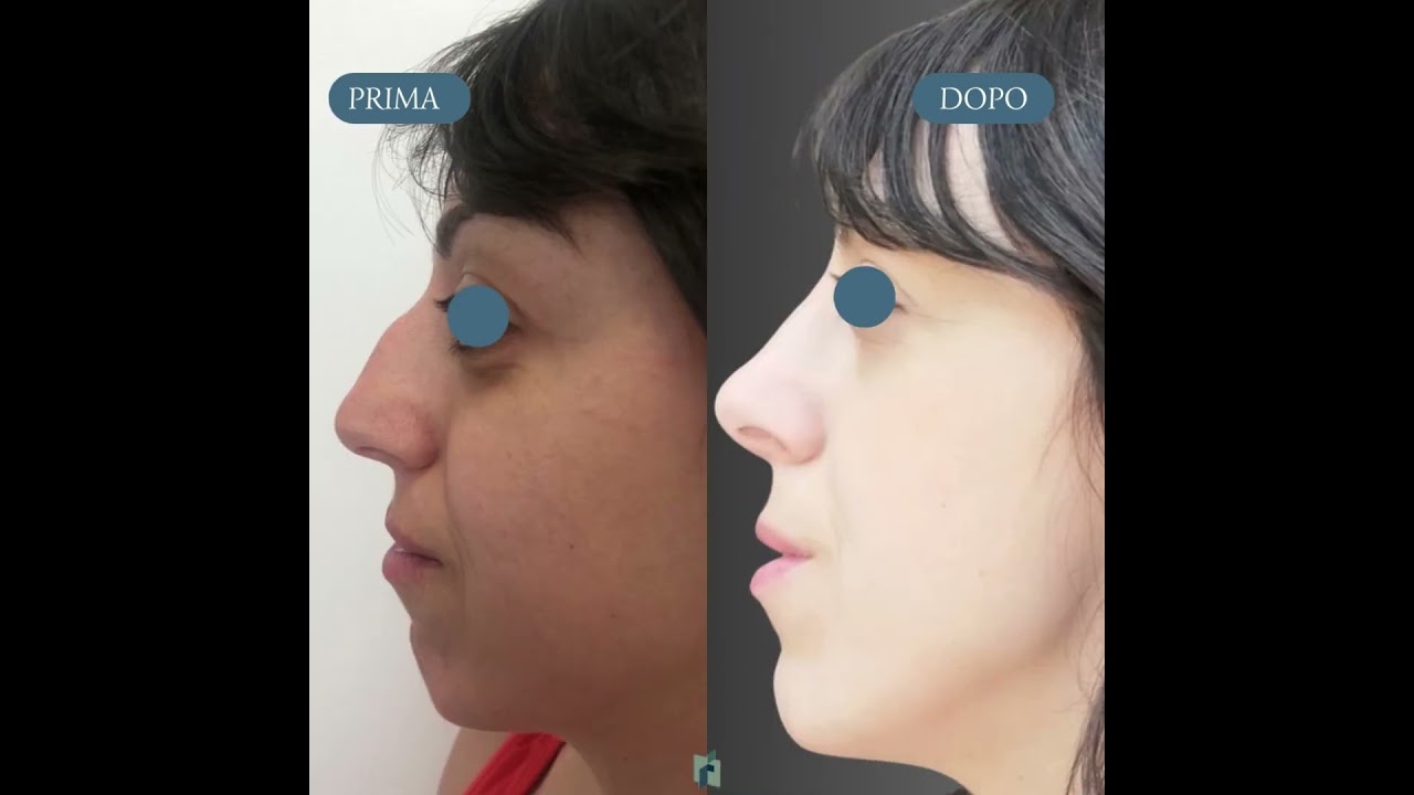 Fioravante Orefice-26