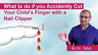 What to do if you Accidentally Cut Your Child's Finger with a Nail Clipper