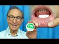 ZYN - Oral Health Risks and Benefits! Reviewed by Dr. Nemeth