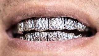 CUSTOM GOLD GRILLZ | WHAT YOU NEED TO KNOW