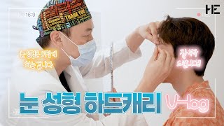 [리얼모델] #속쌍꺼풀 #리얼모델 #매몰쌍꺼풀수술 #남자눈매교정