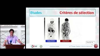 Théranostique dans le cancer de la prostate (Dr A/K TALBI)