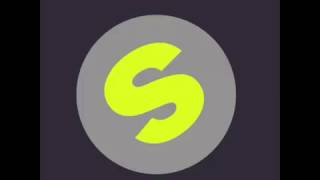 Bingo Players   When I Dip Original Mix