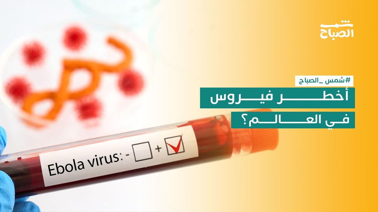 فيديو | فيروس إيبولا.. كيف ينتقل وما مدى خطورته؟
