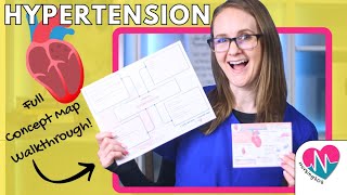Hypertension Concept Map | PLUS The Must Know NCLEX® Points