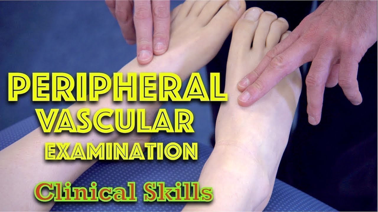 Peripheral Vascular Examination - Clinical Skills - Dr Gill