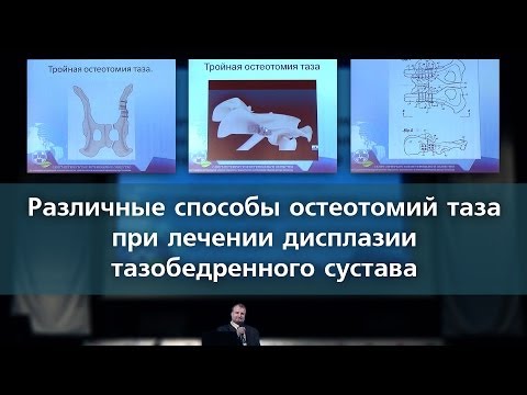 Боль в спине лежать или двигаться Если затруднено дыхание и боли в спине